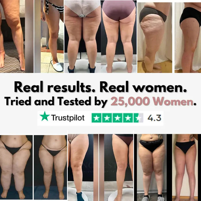 Mallas Venbelia 3D: Despídete de forma natural del dolor y la hinchazón del lipedema