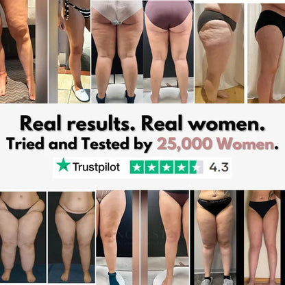Mallas Venbelia 3D: Despídete de forma natural del dolor y la hinchazón del lipedema